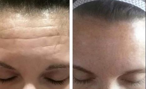 Magic Eye Cream – remove eye bags/dark circles/eye wrinkles