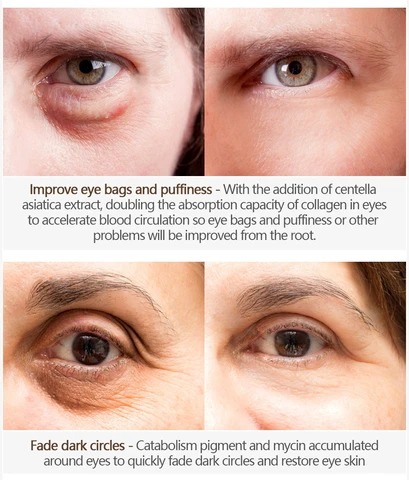 Magic Eye Cream – remove eye bags/dark circles/eye wrinkles